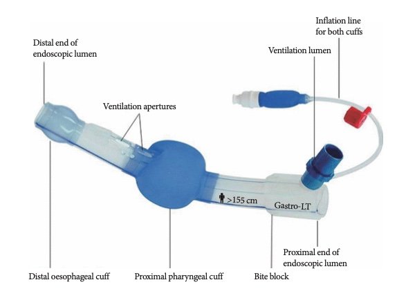 Airway Management in Endoscopy suite – Anesthesia Optimal Solutions